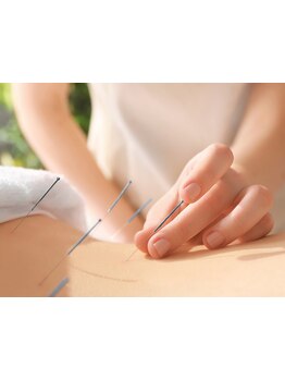 鍼灸施術を受けたい