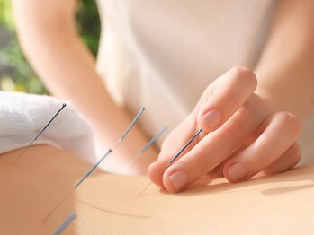 あやせ駅前ひだまり整骨院の写真/【深いコリ・疲れ・ストレスを根本リセット】国家資格者が一人ひとりの症状に合わせて丁寧に施術します◎