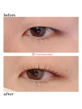 ビビデバビデ(Vivide Vavide)/【マツパ】下がらない!超上向き