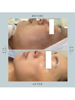 スプレール 水戸店/ExoLif(エクソリフト)