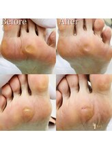 巻き爪補正店 湘南辻堂店/タコ・魚の目ケア