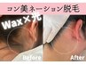 うなじのお手入れ：その場でツルっと【WAX×光】【コン美ネーション脱毛】