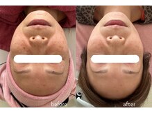 ナンバーナイン(No.9)/結果にこだわるシミケア