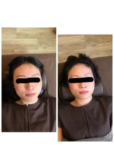 アウフハベン(Aufheben)/■小顔に導く