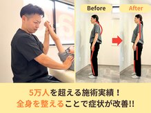 アオ(ao)/総施術数5万人を超える実績！