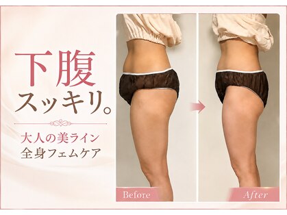 パラアモール(Paraamor)の写真