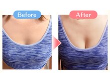 ヒーリング スポット/【Before＆After】