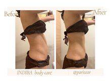 パリワール(pariwar)/インディバ＊ビフォーアフター