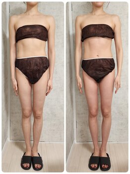 ヴィセル(VISEL)/トータルマイナス10cm痩身