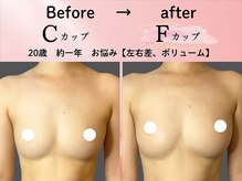 ロットプラス(Lot Plus)の雰囲気（一人一人にオーダーメイド施術でバストアップ。お悩み同時改善）