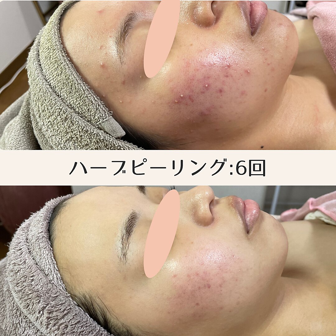 エムリシェ(M.riche)｜ホットペッパービューティー