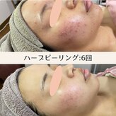 エムリシェ(M.riche)