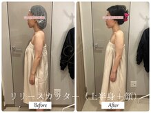 リノ(Lino)/ブライダルエステでご来店♪