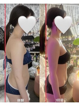 ビルーチェ(美LUCE)/栄養管理師(23)3回で変化!-3.9kg
