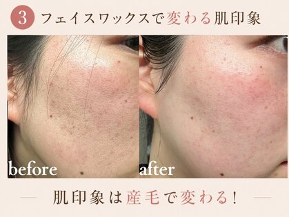 コモレビ(komorebi)の写真