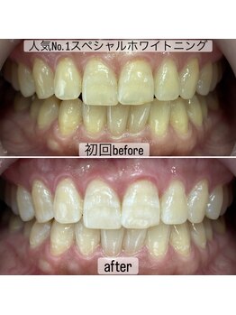 ヤット 森ノ宮(yatto.)の写真/歯科衛生士による施術で、歯本来の憧れの白さに導きます♪お悩みお気軽にご相談ください!