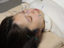 燈縁 ひよりの雰囲気（顔のむくみ、顎の開き、眼精疲労に♪）