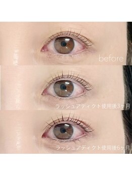 凛/ラッシュアディクト美容液☆★