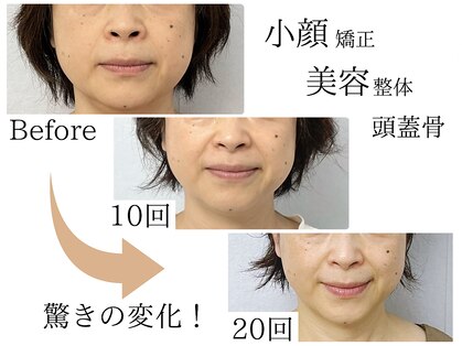 キュット(Qtto)の写真