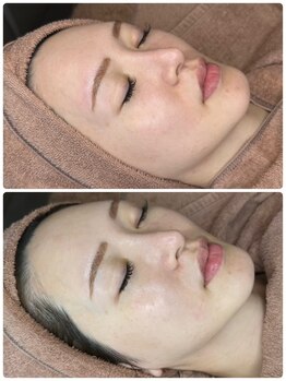 ラナ(Lana)/【ララピール】1回☆