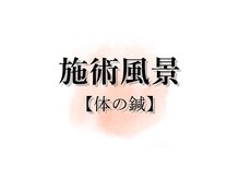 アキュレ(Acure)/体の鍼