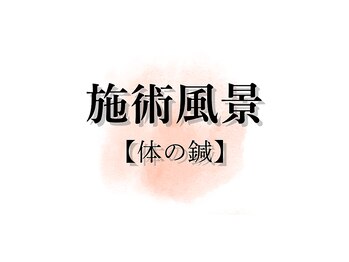 アキュレ(Acure)/体の鍼