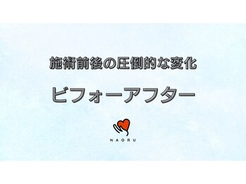 ナオル整体 北千住院(NAORU整体)/施術ビフォーアフター