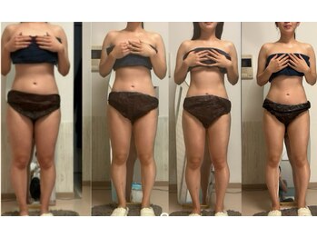 オーシャンブルーム 目黒(OceanBloom)/ハイパーナイフ／内臓脂肪