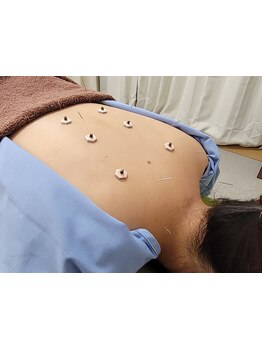 首・肩のつらさを改善したい