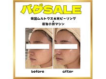 ラウレア(Laule'A)