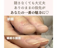 ポノポ(ponopo)