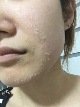 ネイル&エステ Sur【シュール】/