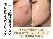 クレア(Claire)
