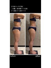 トータルビューティー ミミ(Total Beauty mimi)/下半身もこんなに変わる！！