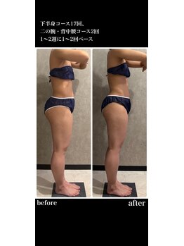 トータルビューティー ミミ(Total Beauty mimi)/下半身もこんなに変わる!!