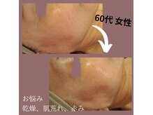 ロッコ 那覇(ROCCO)の雰囲気（乾燥・肌荒れでお悩みの方も！ツヤ肌へ元気にいたします）