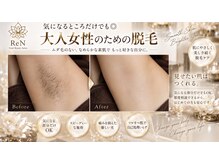 レン(ReN)の雰囲気（気になるところだけでも◎都度相談できる大人女性のための脱毛）