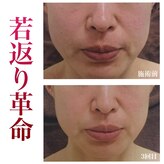 ブランシェ 高岡店 × 椿