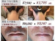 レイジア デイスパ 浜松(Day Spa)の雰囲気（効果で選ぶならレイジア♪痛み抑えた脱毛で頑固なヒゲもお任せ！）