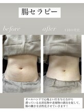 フーレ(Foule)/【腸セラピー】
