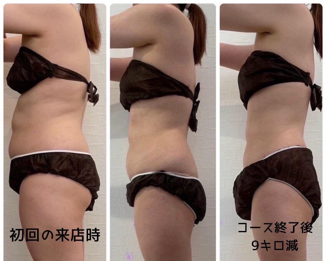 みつば健康温活ダイエットエステサロン 大分店｜ホットペッパー