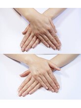 オングレース 東武百貨店池袋店/手のエイジングケア