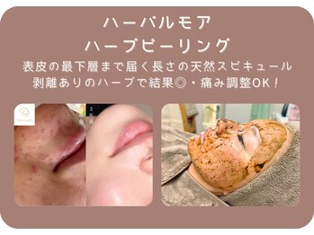 サロンスムースリー 金山駅前店(Salon Smoothly)/深層まで届くハーブピーリング♪