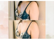 ルナ 千葉(LUNA)/1回施術後