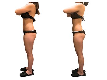 アイル(Isle)/身体の内部からしっかりケア