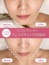 リフト 錦糸町(Lift)&nbsp;肌のお悩み 全て改善♪
