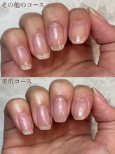 アモット(Amout)/美爪コース