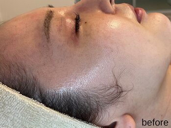 サロン ド エメ(salon de aimer)/【Before】くすみがちなお肌も♪