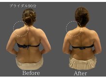 クレビア 麻布十番(CREBIA)/ブライダルエステ4回【痩身】