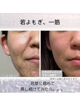 灯/期間限 定若よもぎ モニター価格